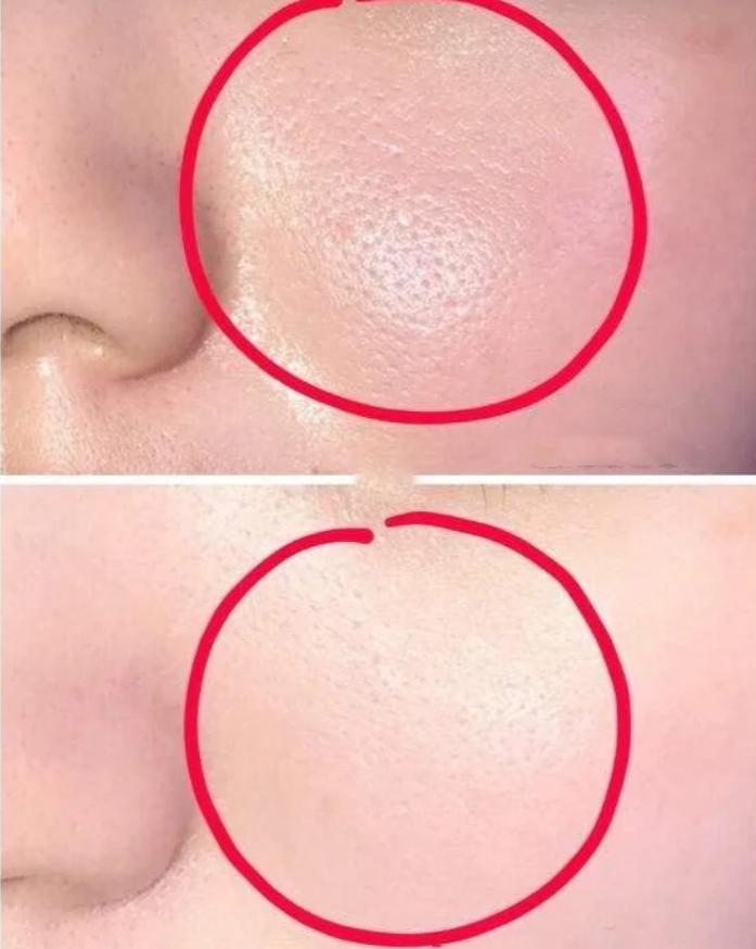 长期去美容院的女人，坚持10年会有哪些变化？网友：不敢信