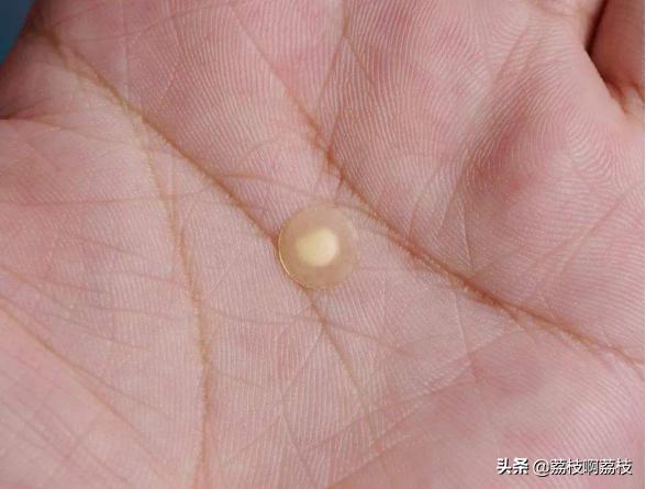 掏了室友脸上一颗大黑头，留了一个大洞，该怎么办？