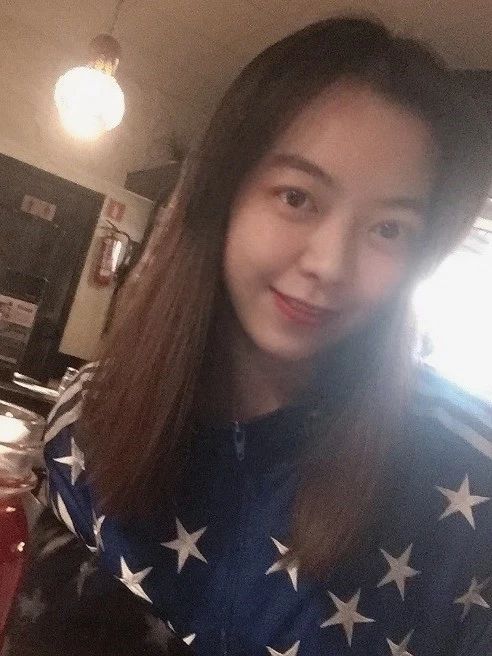 左脸右脸不像同一个人,左右脸很明显的不对称怎么改善