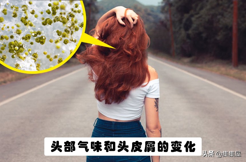 身体出现异常体味,如何判断自己的体味是否正常