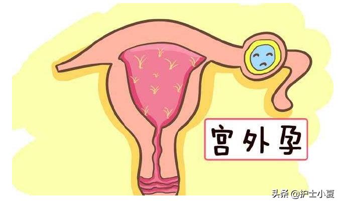 阴道非经期流血的原因是什么？不排除宫外孕、子宫癌及其他原因！