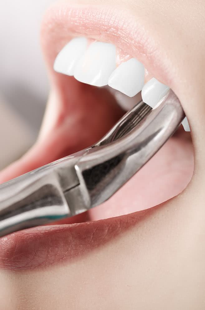 关于拔牙后的注意事项正确说法,70岁老人拔牙注意事项与禁忌症