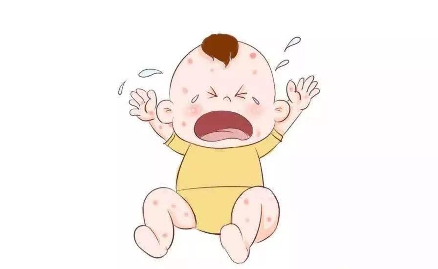 婴儿湿疹反复妈妈要忌口吗,宝宝湿疹反反复复怎么根除