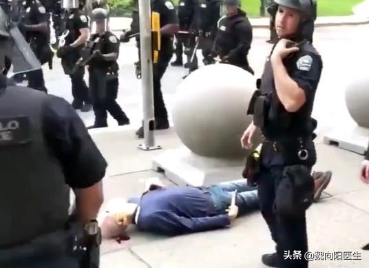 后脑勺着地有什么后果,后脑勺着地死亡率高吗