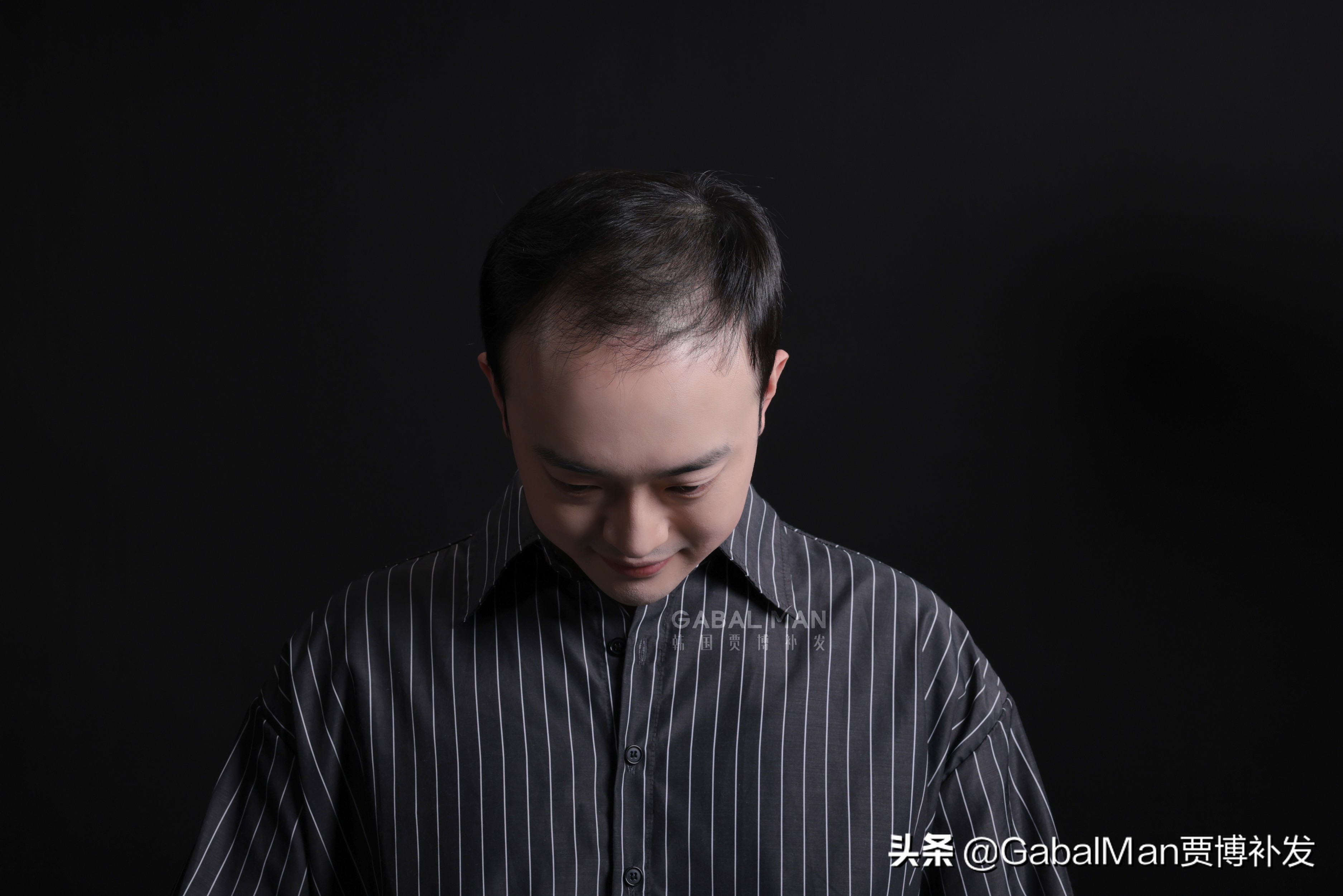 关于头发的搞笑绰号有哪些,关于头发的外号