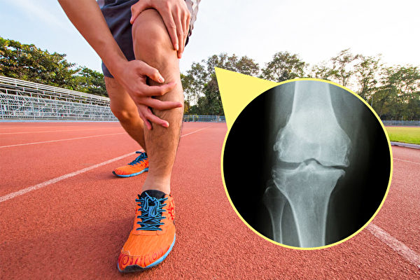 运动膝盖受伤会造成肌肉萎缩吗,运动导致膝盖受损能彻底根治吗