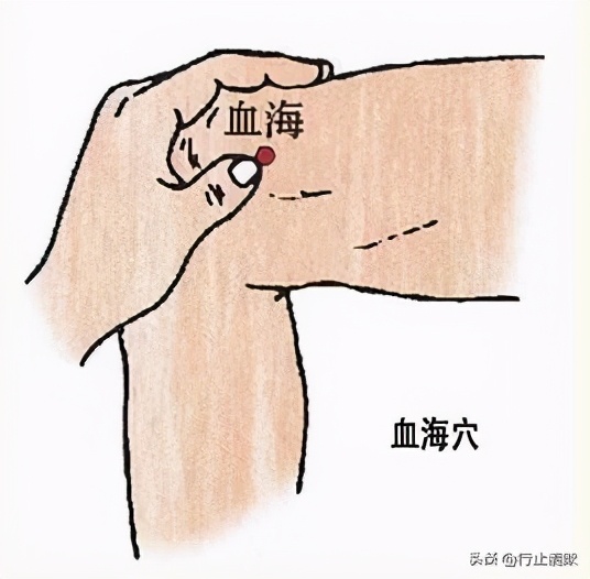 湿疹按啥穴,儿童手部湿疹艾灸取穴