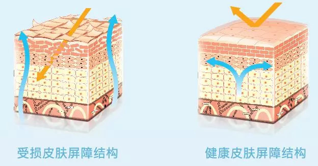 脸皮太干怎么能保湿,脸皮特别干用什么来修复