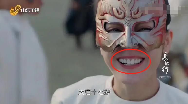 《长歌行》迪丽热巴咧嘴大笑,烤瓷牙“抢镜”忒显老