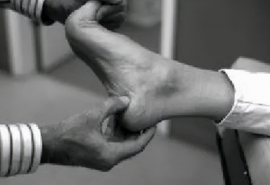 跟骨骨折和足跟骨刺哪个严重,足跟骨刺走路疼痛该如何治疗