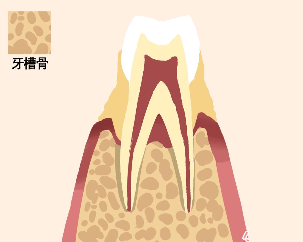 怎样取下一颗牙齿,快要脱落的牙齿怎么拯救