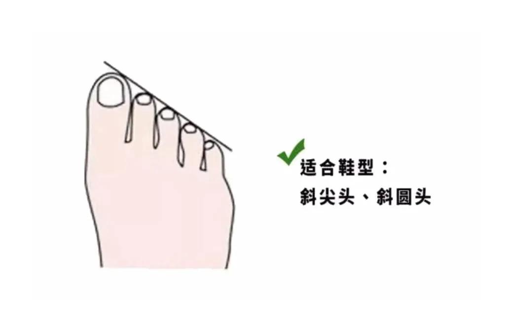 夏天穿凉鞋的季节，不懂脚型，选错鞋子又丑又磨脚！