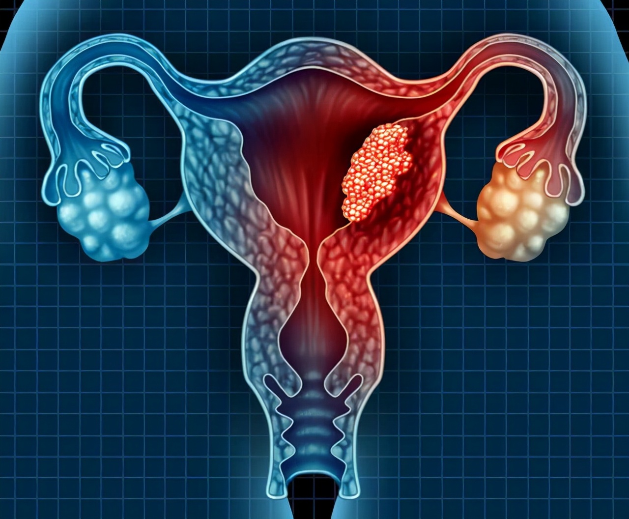 一般有妇科病都注意哪些,女性常见的哪些疾病不要治