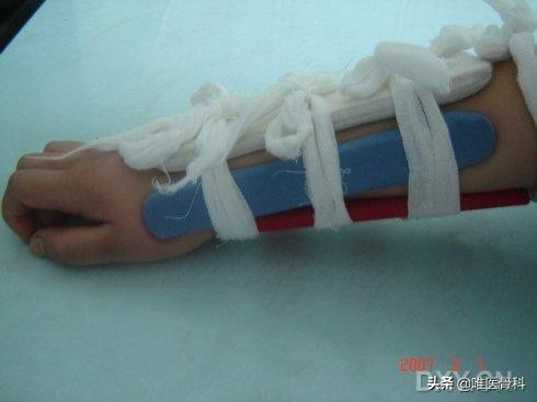 一文读懂注意力机制,一文读懂这些事儿