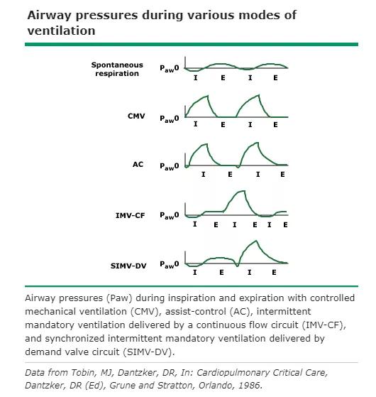 机械通气模式中持续气道正压是指,机械通气模式大全
