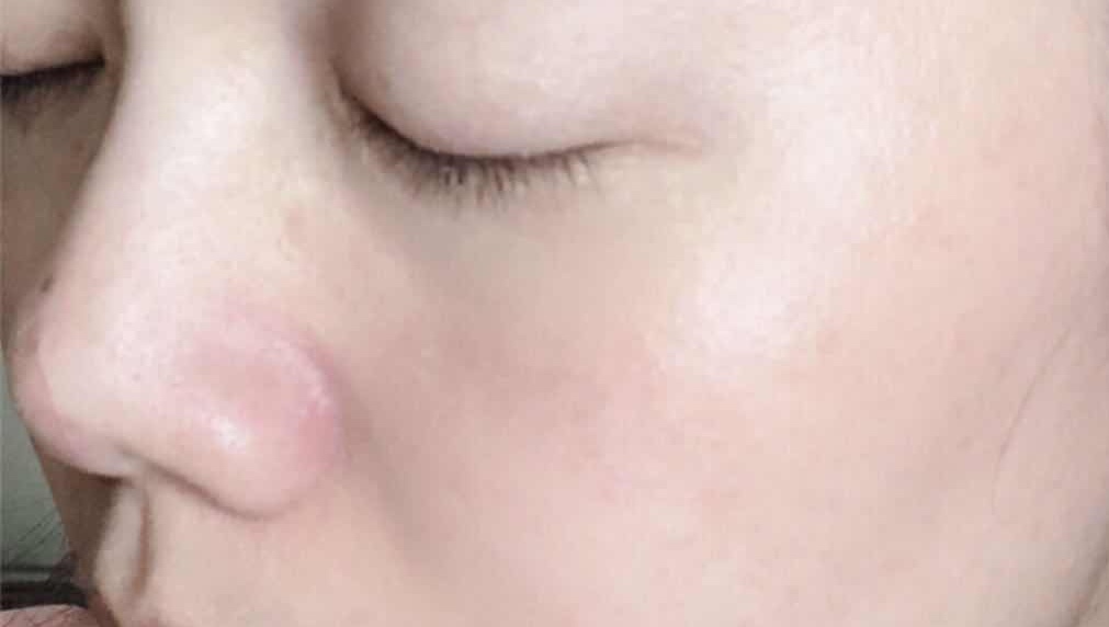 晒伤皮肤修护推荐,适合晒伤修复的护肤品