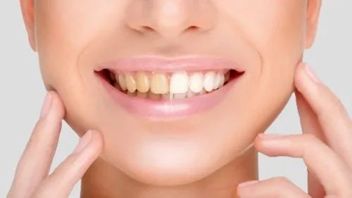 26岁牙齿参差不齐能矫正吗,26岁牙齿还会越来越歪吗