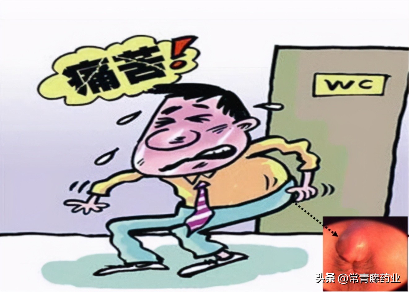 肛门直肠脓肿怎么治疗,直肠肛周脓肿治疗方法