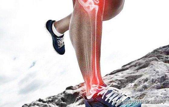 辟谣膝关节,年轻人膝盖有骨刺能根治吗