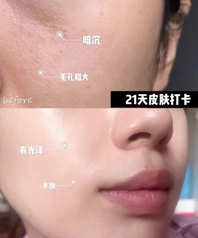 微整形美白针,微整形是永久的吗