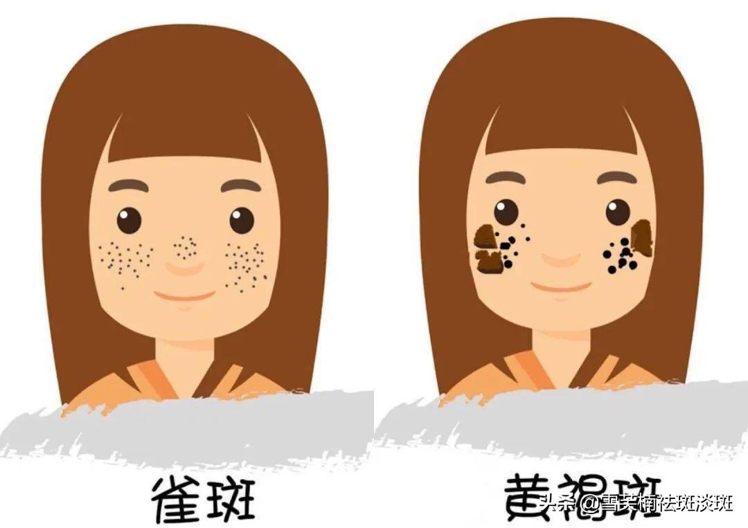 目前最有效最好的祛斑方法,目前最有效果的祛斑方法