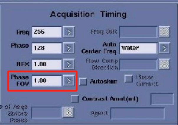 脊柱mr扫描规范,MR扫描各序列特点