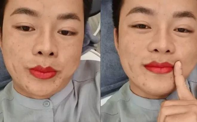 越南女的整容嫁给富二代,越南女人整容成功后嫁给富二代