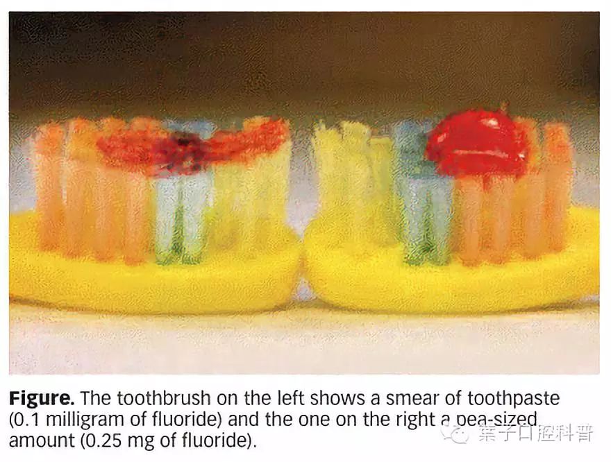 牙齿脱矿白斑怎么修复,牙医修复牙齿漏洞蛀牙全过程