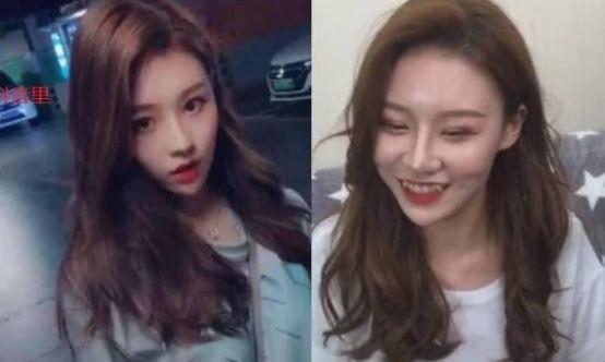 武汉一整形机构*脑洗**女大学生签高息*款贷**，称颜值即未来，外貌焦虑