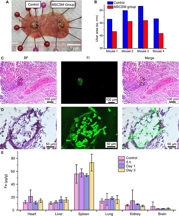 微型机器人和传统机器人结合实现体内狭小腔道的快速高精度递送