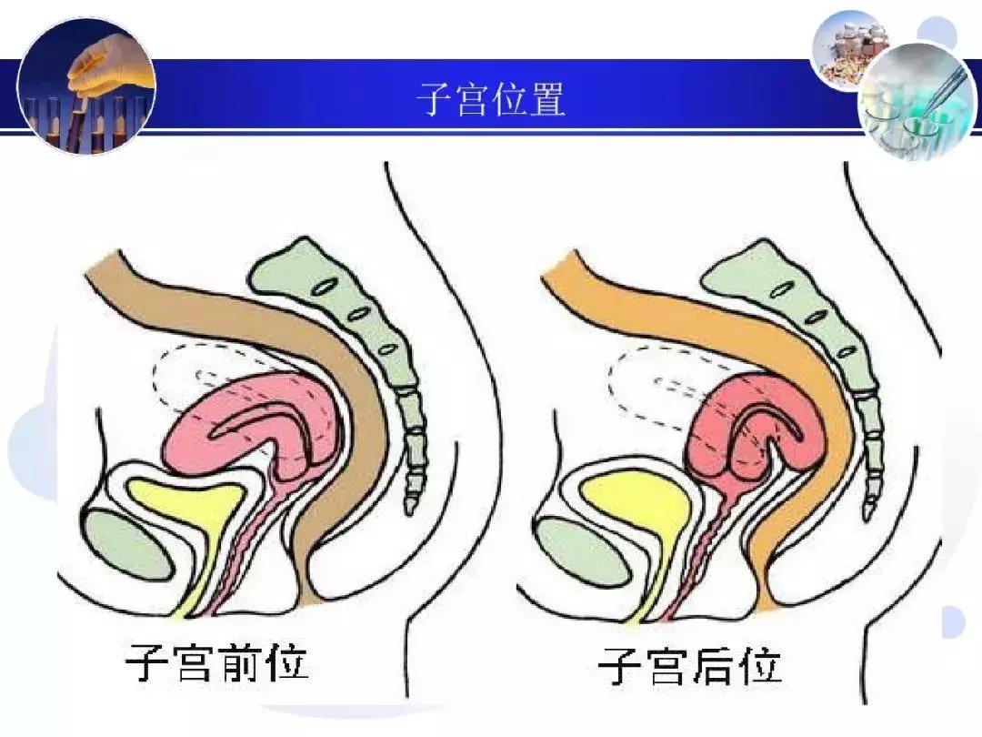 纯干货！子宫及附件解剖和超声诊断
