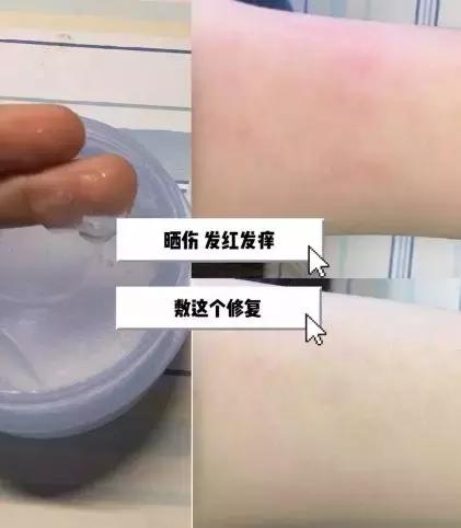 军训后要被晒成碳？史上最强晒后修复攻略，让你快速白回来