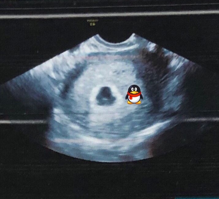 孩子小名多多寓意,孩子小名起名字大全2020