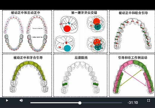 「第58期」基于磨牙检查垫的咬合诊断