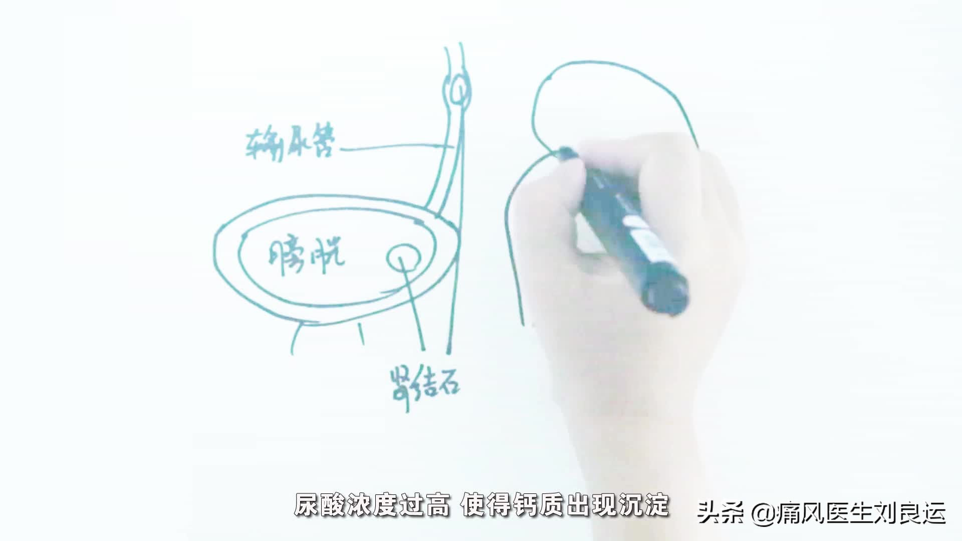 尿频是前列腺炎吗,尿酸高对前列腺有啥影响