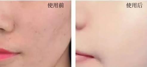 美白抗皱国货之光,提亮美白补水国货之光