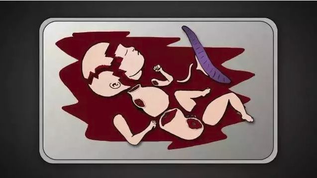 男用避孕药通过试验,网友:叫刘阳打针,半藏森林你不用吃药了