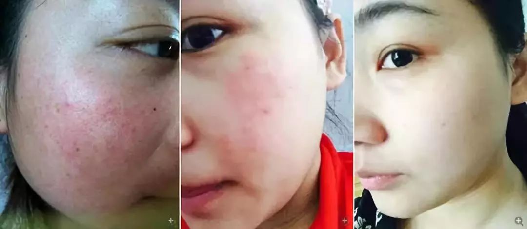 45岁金喜善素颜,金喜善冻龄秘密