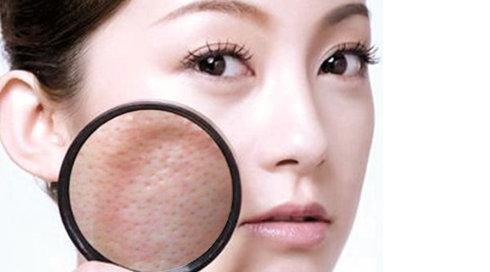 网红平价爽肤水有哪些牌子,又贵又难用的爽肤水