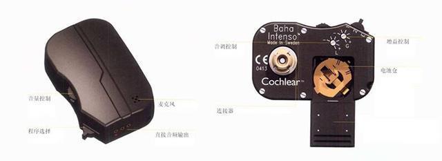 新生儿小耳畸形最佳治疗时间,新生儿耳朵轮廓畸形家长怎么办