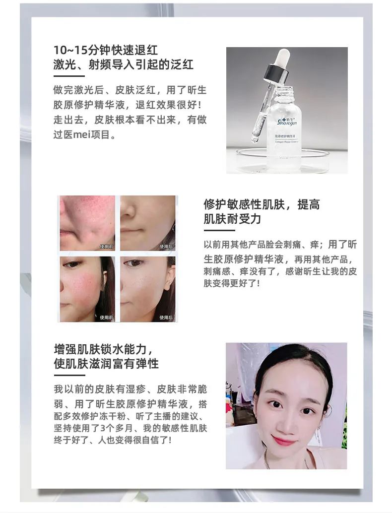 修复屏障又抗老提亮肤色的精华,修复泛红肌肤屏障受损精华