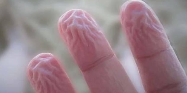 为什么手指泡水后凹凸不平,手指泡水后变腐烂怎么办
