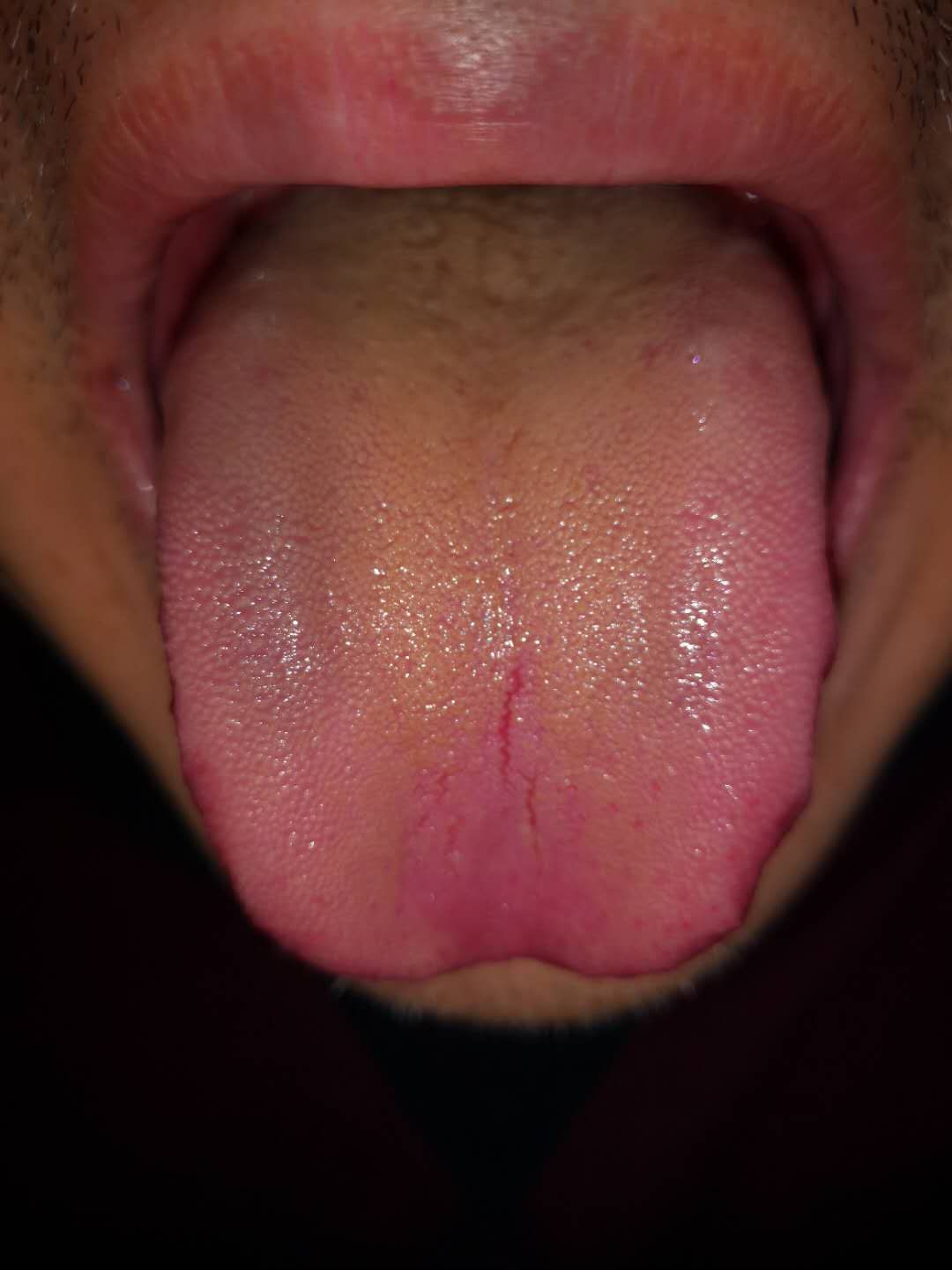 紧急通知:今冬流感的病因找到了,最简单的中医预防方法在此!