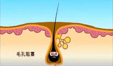 戚薇袁咏仪推荐的洗发水,袁咏仪推荐好用洗发水