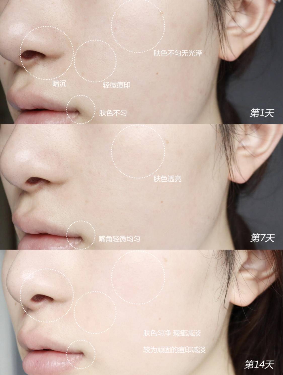 一直在美白却越来越黑的原因,为什么用了美白精华反而黑了