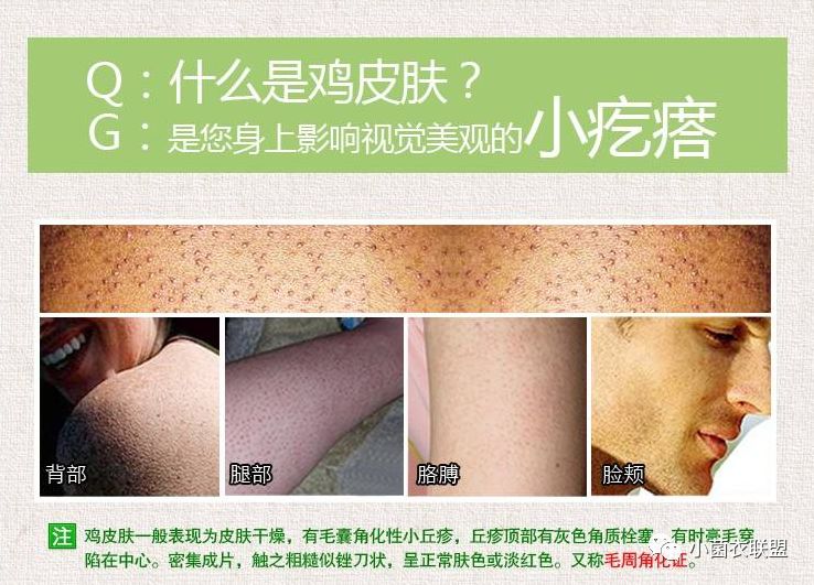 颈部毛囊上长疙瘩图片,大腿小腿毛囊很多红色凸起的小点