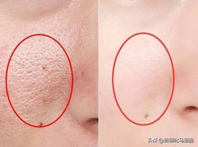 柜姐绝对不会告诉你的护肤,柜姐绝对不会告诉你的护肤秘诀