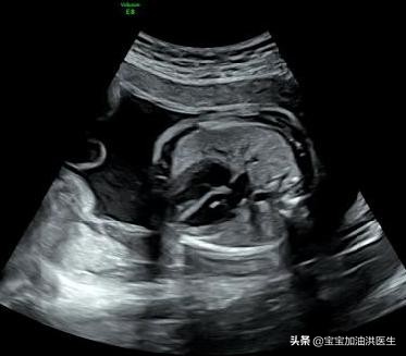 洪医生心脏科,洪医生个人资料