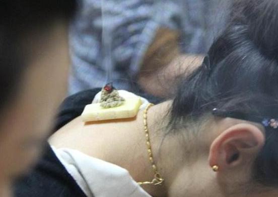 艾灸后疲乏嗜睡没力气,嗜睡能不能在艾灸后缓解