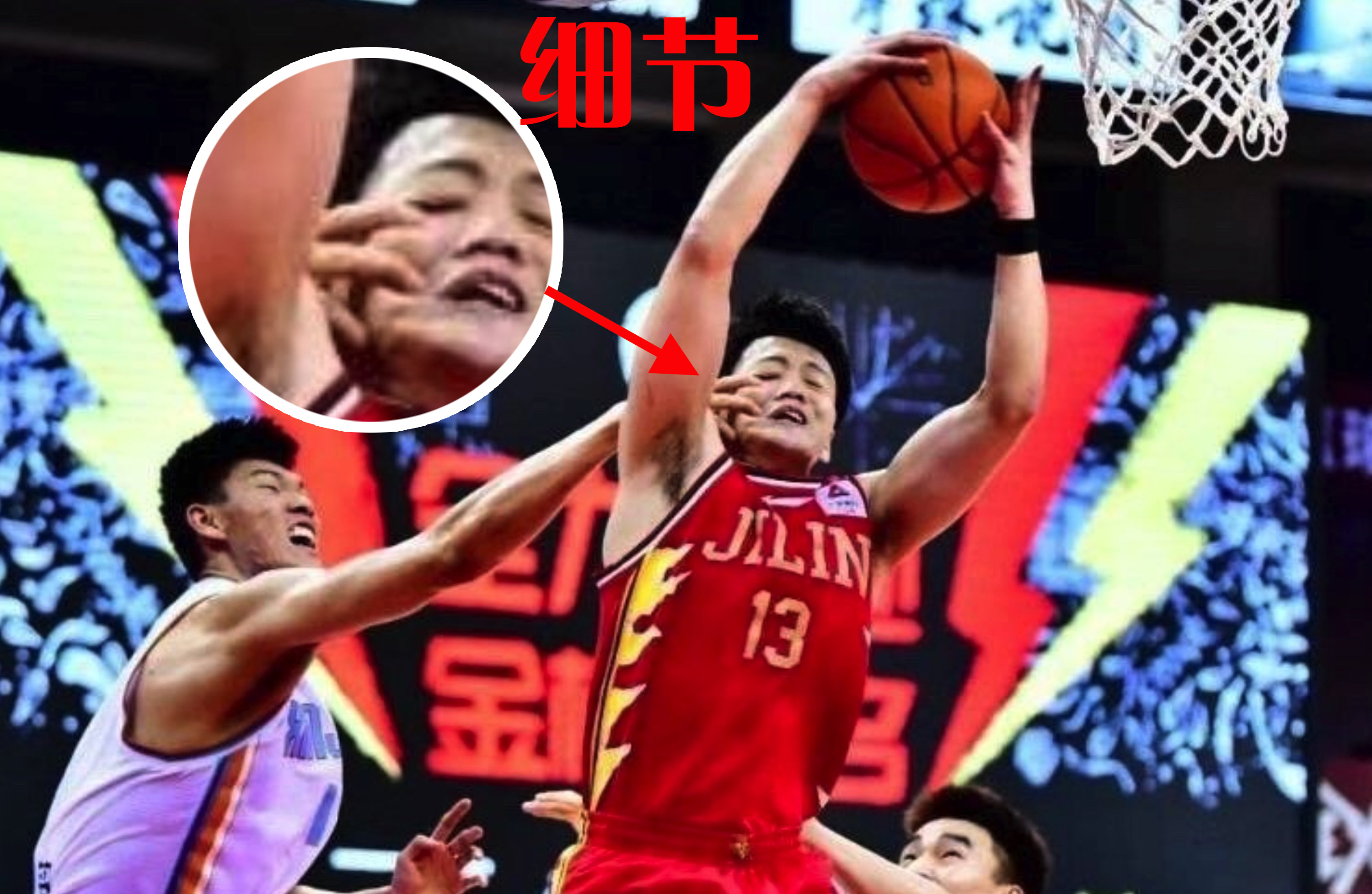 cba球员受伤疼哭,盘点cba球员受伤最严重的